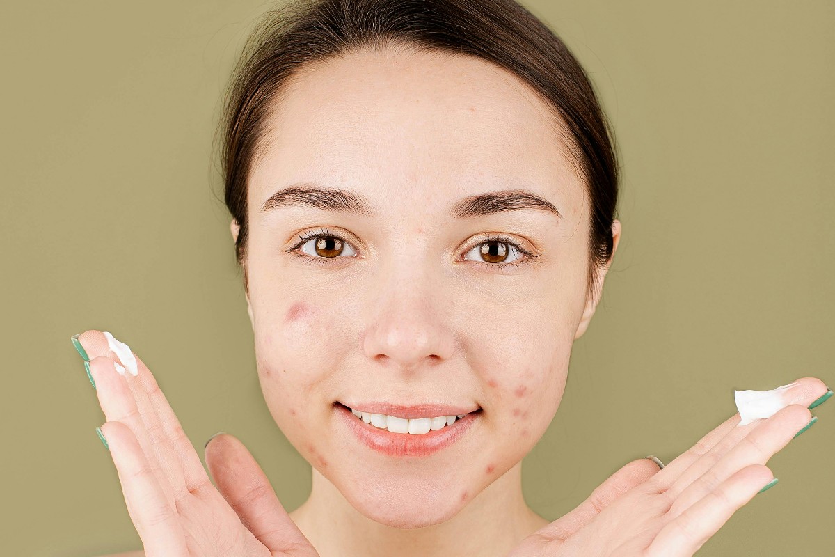 حب الشباب: الأسباب، الأنواع، وطرق العلاج