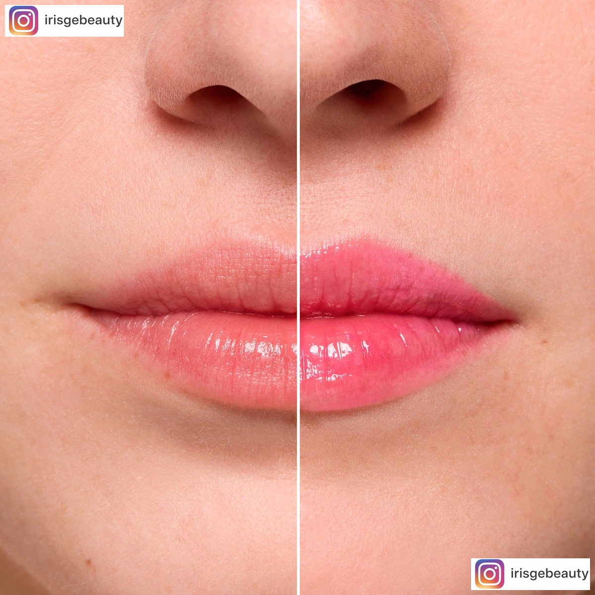 Thumbnail of Lipgloss Juicy Bomb Shiny 107 Glowy Gummy essence