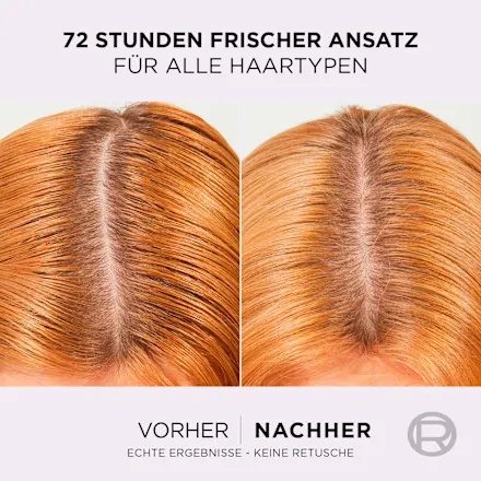 Thumbnail of بلسم هيدرا هيالورونيك بيور من لوريال باريس إلفيتال للفروة الدهنية والشعر الجاف