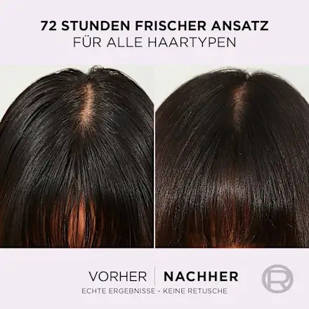 Thumbnail of لوريال باريس إلفيتال سيروم الشعر هيدرا هيالورونيك بيور، 102 مل