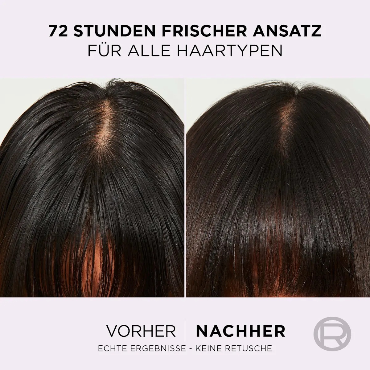 Thumbnail of شامبو لوريال بارس للفروة الدهنية والشعر الجاف بالهايلورونك